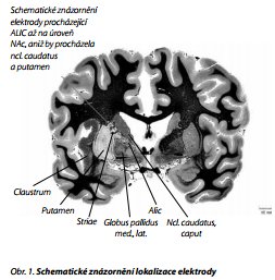 Česká a slovenská psychiatrie