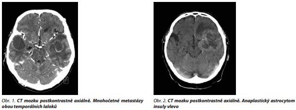 Česká a slovenská psychiatrie