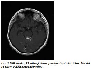 Česká a slovenská psychiatrie